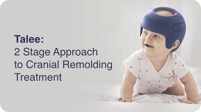 Talee: 2 Stage Approach to Cranial Remolding Treatment